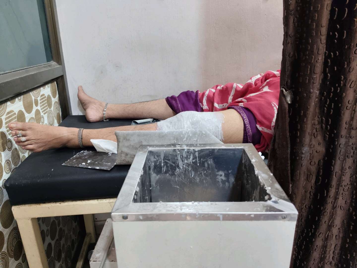 Paraffin Wax Bath Therapy
