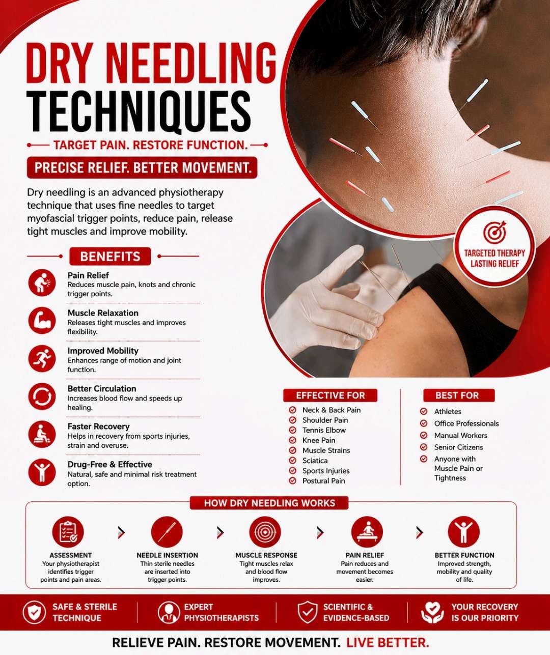 Dry Needling Techniques (Trigger Point)