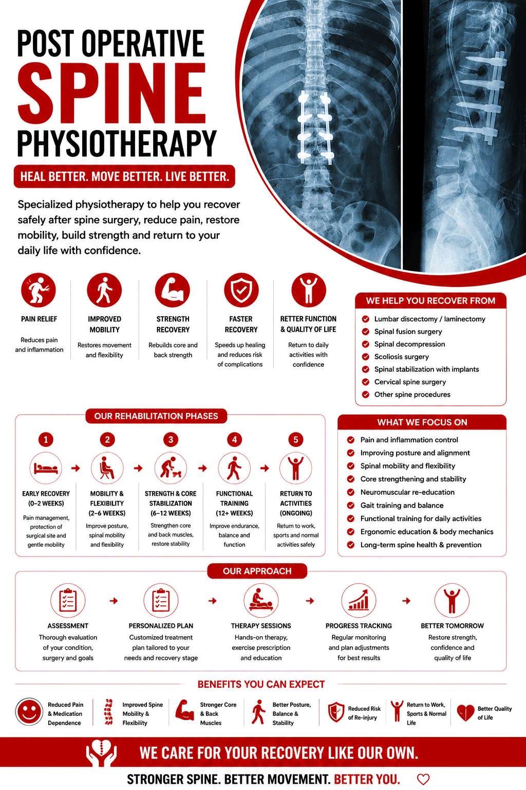 Post-Operative Spine Physiotherapy