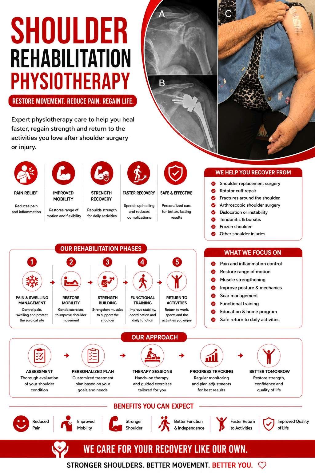 Shoulder Rehabilitation (Rotator Cuff & Frozen)