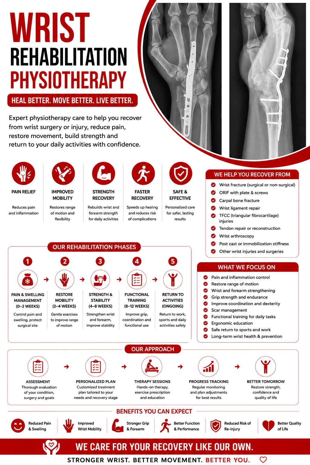Wrist & Hand Rehabilitation (ORIF / Carpal)